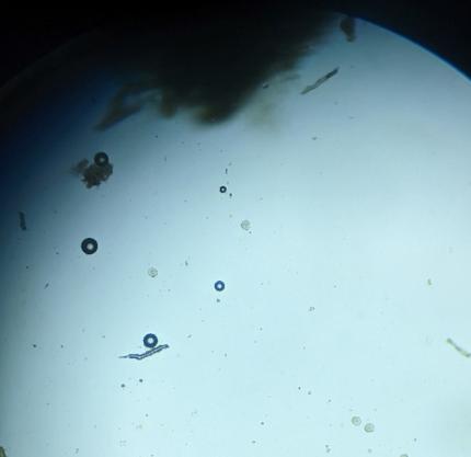 Coccidia, shown by the orange arrows, is found in the B3 enclosure. 